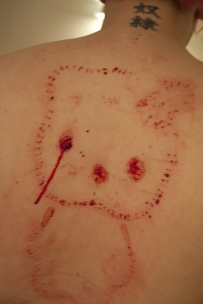 Hello Kitty needles scar Hello Kitty acupuncture needles scar